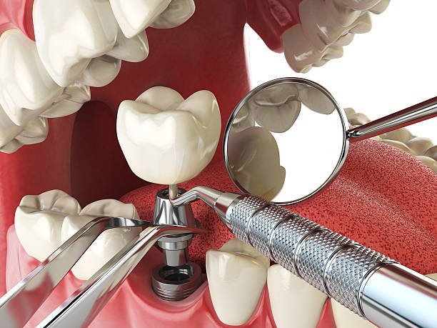 Best Emergency Treatment for Toothache in Susanville, CA